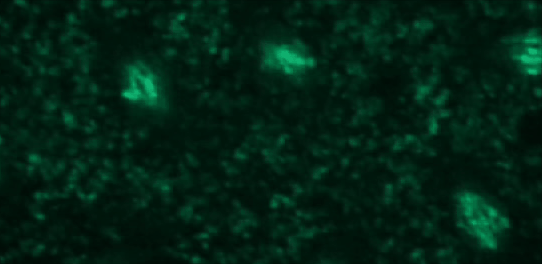 Dividing nuclei.