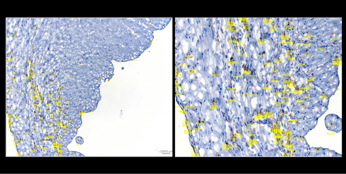 IHC image with detected ROI polygons overlaid in yellow in OMERO. Left: full image scale showing the overall distribution of CD11b-positive detections. Right: zoomed view showing individual ROIs corresponding to small DAB-positive cells scattered across the cardiac tissue.