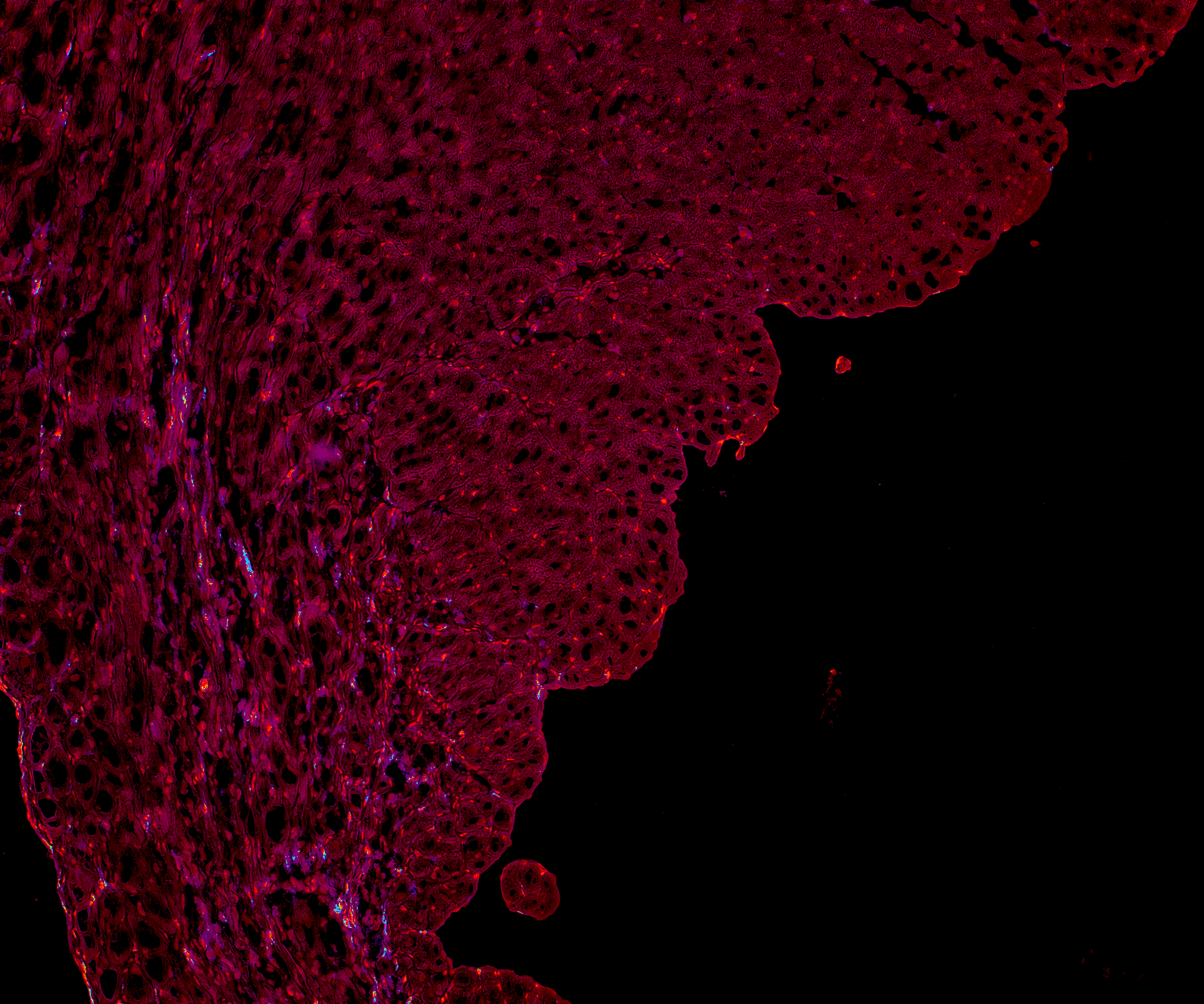 Color deconvolution output for IHC. 