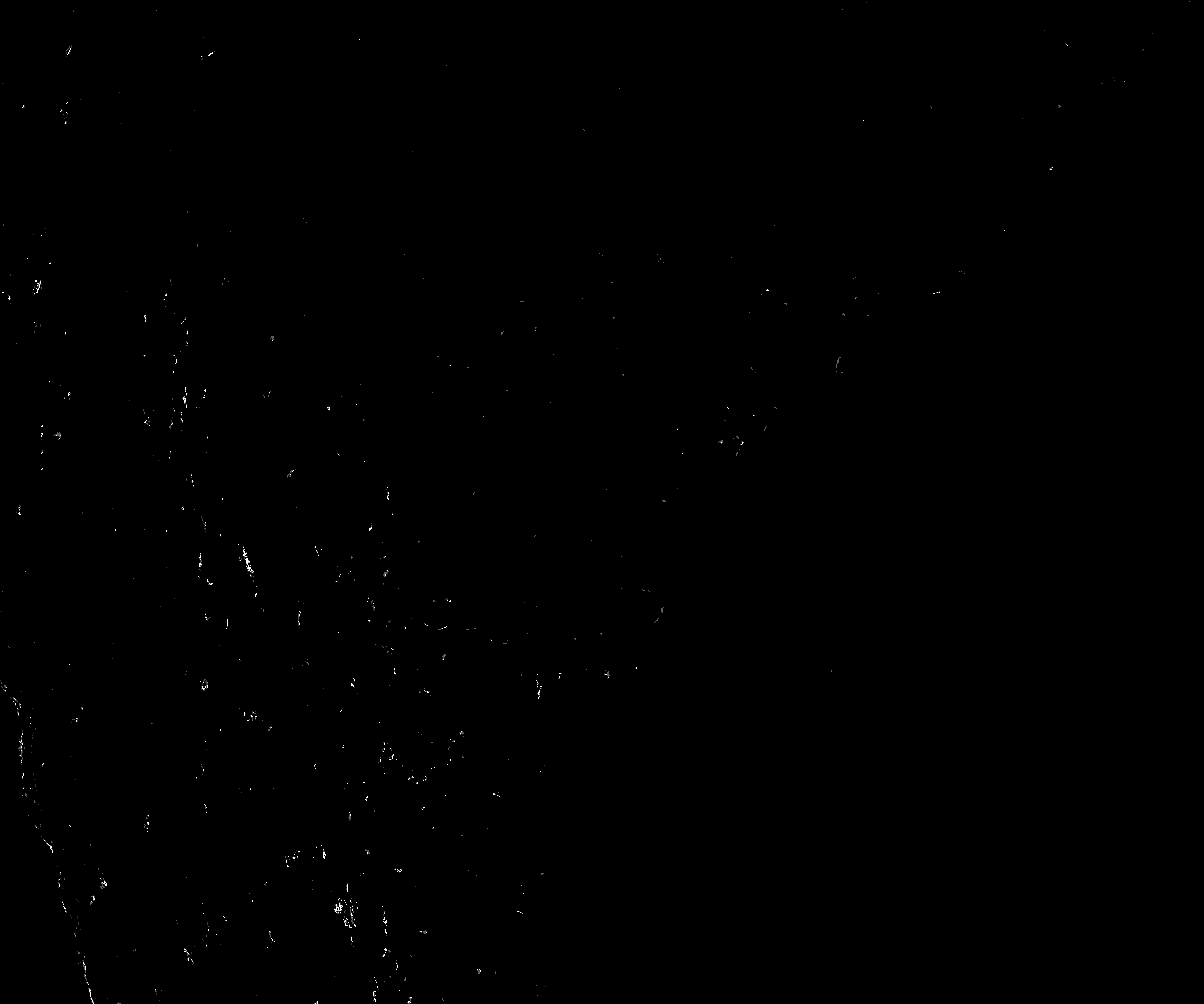 Isolated DAB channel after splitting the deconvolution output. The grayscale image shows the CD11b/DAB signal separated from the other stain components.