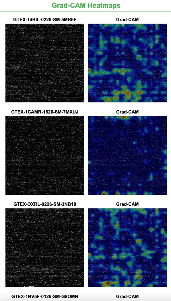 Grad-CAM heatmaps.