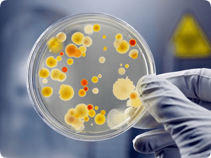 petri dish with bacterial cultures