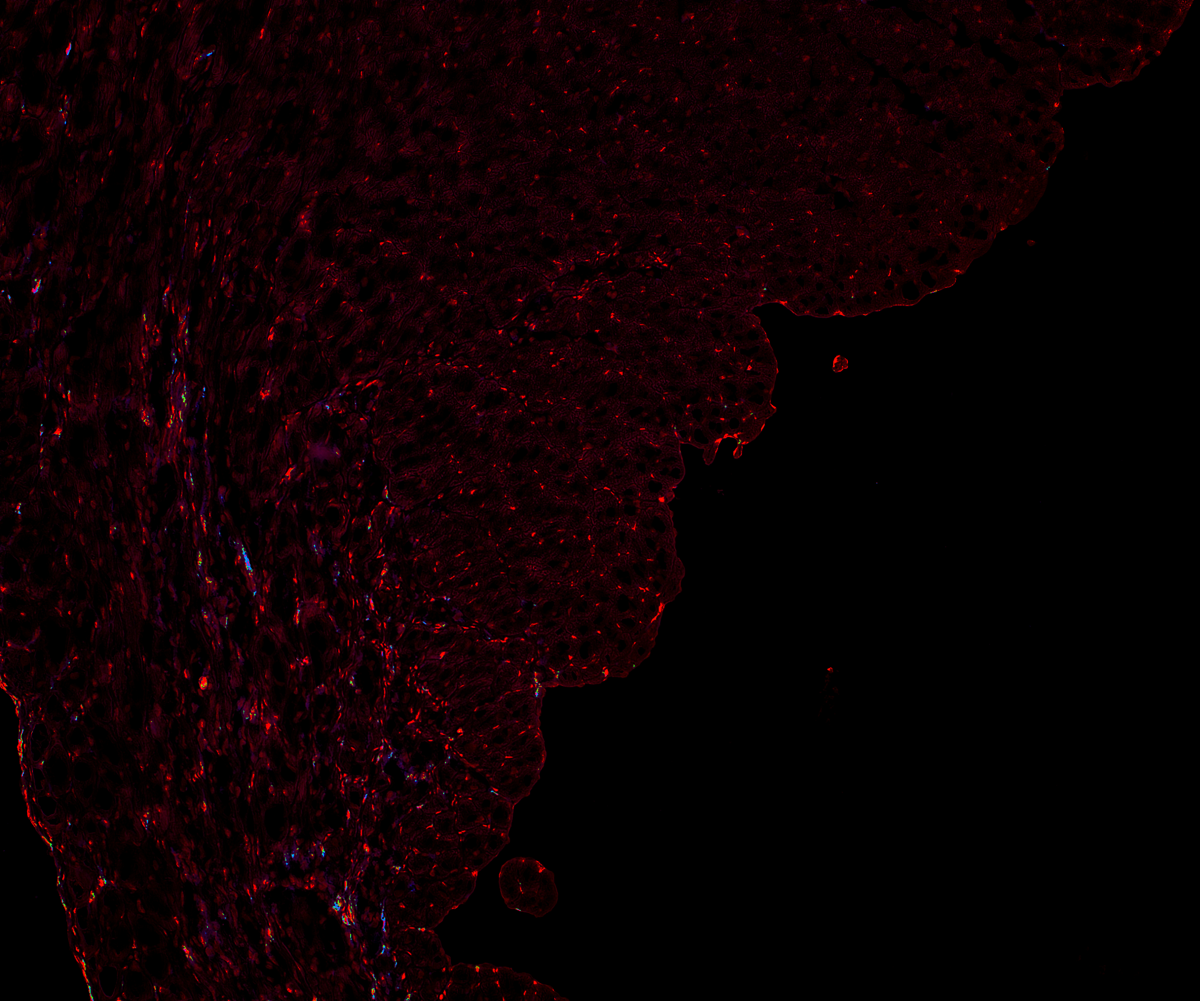 Color deconvolution output for IHC. 