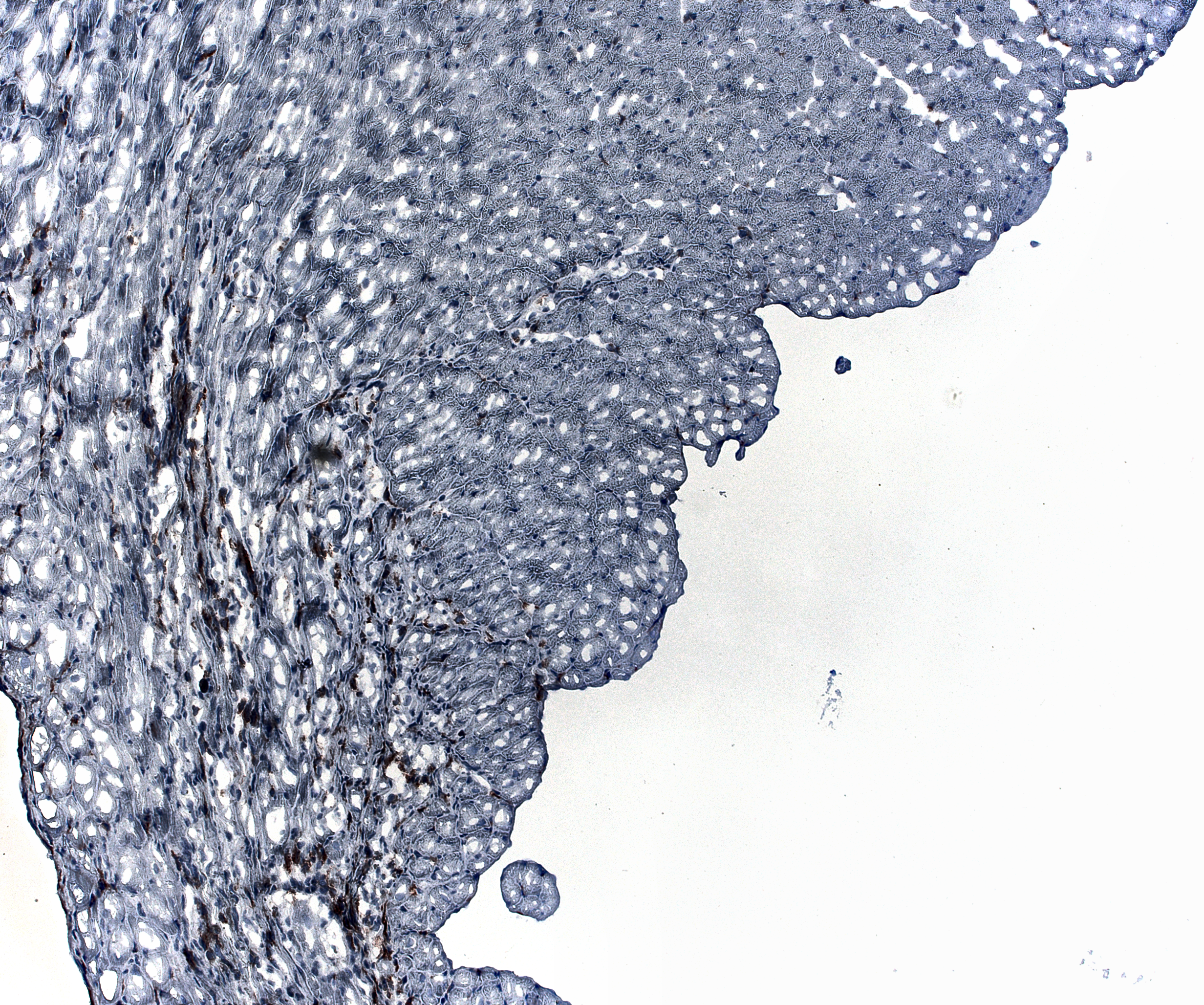 Example output after CLAHE histogram equalization. 