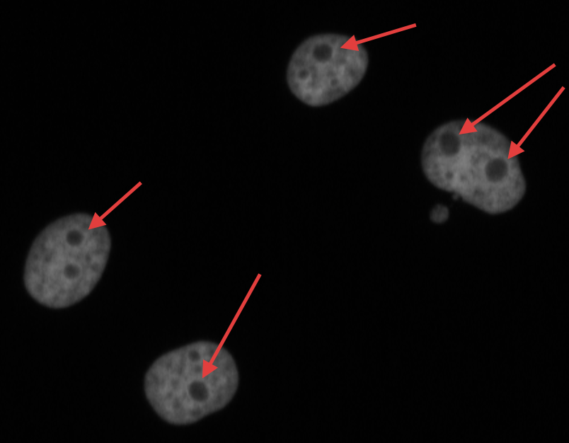 image of four cells, one is dividing, and red arrows point to the 5 nucleii. 