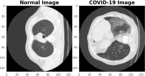 Normal and Covid CT scans. 