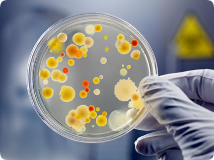 petri dish with bacterial cultures. 